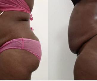 Before and after body result, real DNS client, no face shown