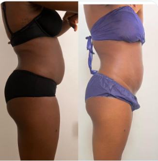 Before and after body result, real DNS client, no face shown