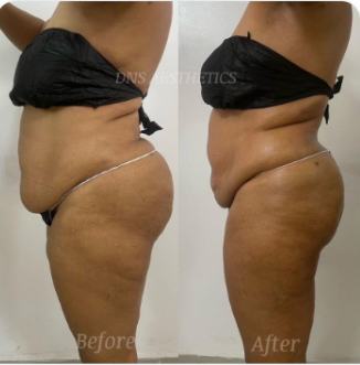 Before and after body result, real DNS client, no face shown