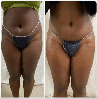 Before and after body result, real DNS client, no face shown