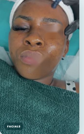 Skin treatment at DNS Aesthetics