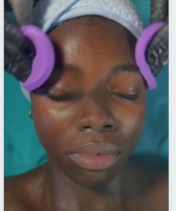 Acne and facials at DNS Aesthetics