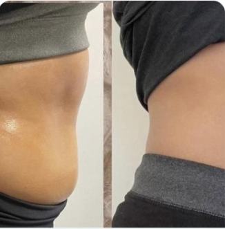 Before and after body result, real DNS client, no face shown
